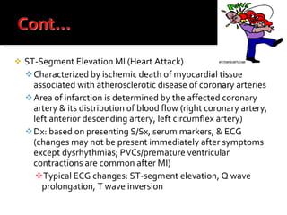 ST-Segment Elevation MI (Heart Attack) Characterized by ischemic death of myocardial  tis sue associated with atherosclerotic disease of coro nar y arteries Area of infarction is determined by the affected coronary artery & its distribution of blood flow (right coronary artery, left anterior descending artery, left circumflex artery) Dx: based on presenting S/Sx, serum markers, & ECG (changes may not be present immediately after symptoms except dysrhythmias; PVCs/premature ventricular contractions are common after MI) Typical ECG changes: ST-segment elevation, Q wave prolongation, T wave inversion 