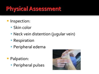 Inspection: Skin color Neck vein distention (jugular vein) Respiration Peripheral edema Palpation: Peripheral pulses 