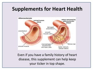 Supplements for Heart Health
Even if you have a family history of heart
disease, this supplement can help keep
your ticker in top shape.
 