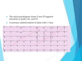 u  The electrocardiogram shows 2-mm ST-segment
elevation in leads I,V2, and V3.
u  A coronary catheterization Iis done witin 1 hour.
 