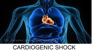CARDIOGENIC SHOCK
 