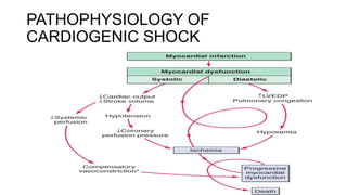 PATHOPHYSIOLOGY OF
CARDIOGENIC SHOCK
 