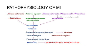 PATHOPHYSIOLOGY OF MI
 