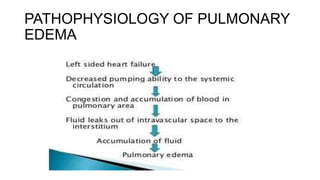 PATHOPHYSIOLOGY OF PULMONARY
EDEMA
 
