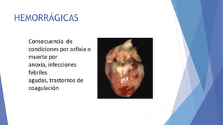 HEMORRÁGICAS
 