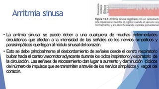 Arritmia sinusa
• La arritmia sinusal se puede deber a una cualquiera de muchas enfermedades
circulatorias que afectan a la intensidad de las señales de los nervios simpáticos y
parasimpáticos quelleganalnódulosinusaldelcorazón.
• Esto se debe principalmente al desbordamiento de señales desde el centro respiratorio
bulbarhaciaelcentrovasomotoradyacentedurantelosciclosinspiratorioyespiratorio de
la circulación. Las señales de rebosamiento dan lugar a aumento y disminución cíclicos
delnúmerodeimpulsosquesetransmitenatravésdelosnerviossimpáticosy vagosdel
corazón.
 