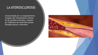 LA ATEROSCLEROSIS
Caracterizada por un engrosamiento
irregular del revestimiento interior
de las paredes arteriales, causado
por depósitos de materiales grasos
llamados placas o ateromas.
 