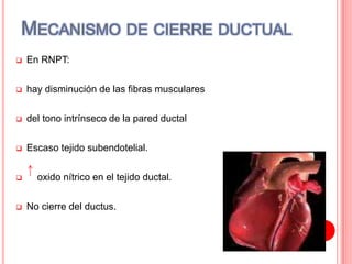  En RNPT:
 hay disminución de las fibras musculares
 del tono intrínseco de la pared ductal
 Escaso tejido subendotelial.
 oxido nítrico en el tejido ductal.
 No cierre del ductus.
MECANISMO DE CIERRE DUCTUAL
 