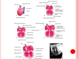 Cardiogenesis | PPTX