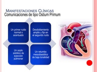 Un primer ruido
normal o
acentuado
Desdoblamiento
amplio y fijo en
el segundo ruido
Un soplo
sistólico de
eyección
pulmonar
Un retumbo
mesodiastólico
de baja tonalidad
MANIFESTACIONES CLÍNICAS
 