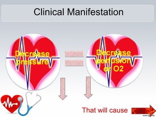 Clinical Manifestation
That will cause
 