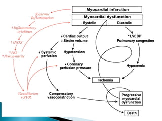 Management of Cardiogenic shock | PPT
