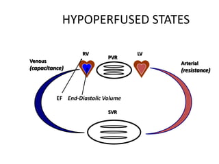 HYPOPERFUSED STATES
RV LV
Arterial
(resistance)
Venous
(capacitance)
PVR
EF End-Diastolic Volume
SVR
 
