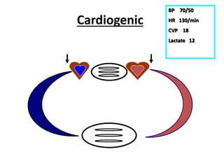 Cardiogenic
BP 70/50
HR 130/min
CVP 18
Lactate 12
 
