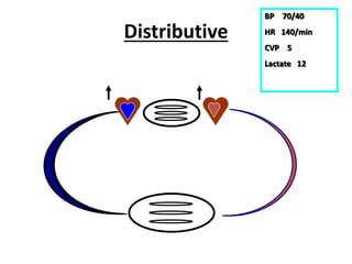 Distributive
BP 70/40
HR 140/min
CVP 5
Lactate 12
 