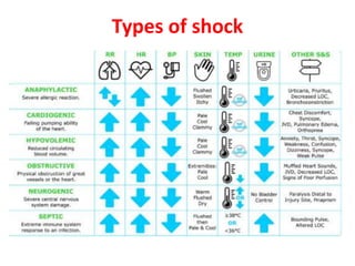 Types of shock
 