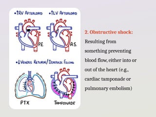 Obstructive Shock Heart Example Cardiogenic Shock ppt for Cardiovascular System | PPTX