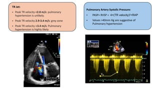 Tr Jet Rvsp Cardiogenic Shock 2.pdf important and helpful | PDF