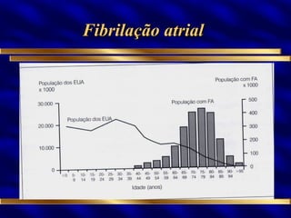 Fibrilação atrial  