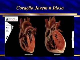 Coração Jovem # Idoso 