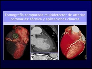 Imágenes en cardiología y algo más