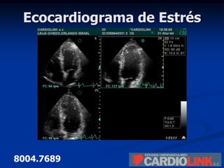 Cardiolink | PPTX