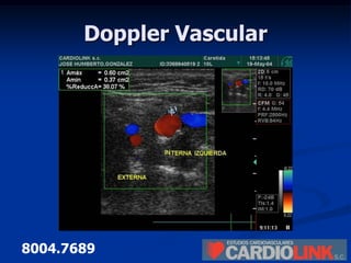 Cardiolink | PPTX