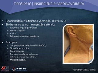TIPOS DE IC | INSUFICIÊNCIA CARDÍACA DIREITA 
• Relacionado à insuficiência ventricular direita (IVD) 
• Sindrome cursa com congestão sistêmica 
– Turgência jugular patológica 
– Hepatomegalia 
– Ascite 
– Edema de membros inferiores 
• Exemplos: 
– Cor pulmonale (relacionado à DPOC), 
– Obesidade morbida, 
– Pneumopatias, 
– Tromboembolismo pulmonar 
– Infarto do ventrículo direito 
– Miocardiopatias. 
INSUFICIÊNCIA CARDÍACA CRÔNICA 
 