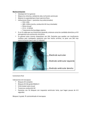 Resincronizacion((
• Salvataje!de!IC!en!general.!
• Mejora!los!síntomas,!calidad!de!vida!y!la!función!ventricular!!
• Mejoran!la!capacidad!para!hacer!ejercicio!físico!
• Indicaciones!(Clase!I!–!pacientes!muy!seleccionados)!!
o FEVI!<35%!
o QRS!>120ms!(ancho,!conducción!AV!muy!retardada)!
o Ritmo!sinusal!
o CF!III!–!IV!NYHA!
o Tratamiento!farmacológico!óptimo!
• Es!un!3r!cable!que!va!al!Ventrículo!izquierdo,!entonces!censa!las!cavidades!derechas!y!el!VI!
para!general!una!contracción!sincrónica.!!
• En! general! estos! mismos! dispositivos! son! DAI.! Pacientes! que! quedan! con! insuficiencia!
cardiaca! post! cardiopatía! isquémica! que! han! hecho! arritmia,! se! pone! une! DAI! mas!
resincronizacion!(pero!vale!12!millones)!!
!
!
!
Comentario!final!
!
Indicaciones!de!marcapaso:!!
• Bloqueo!AV!completo!
• Bloqueo!AV!2do!grado!Mobitz!II!
• Enfermedad!nodo!sinusal!
• Trastornos!conducción!AV!
• Pacientes! con! FA! bloqueo! con! respuesta! ventricular! lenta,! que! hagan! pausas! de! 4g5!
segundos!!
!
Bloqueo!1r!grado!"!contraindicado!el!marcapaso!
 