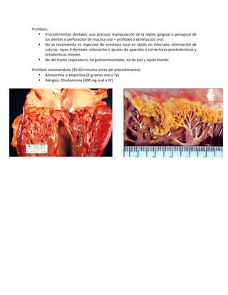 Profilaxis:)
• Procedimientos)dentales:)que)precisan)manipulación)de)la)región)gingival)o)periapical)de)
los)dientes)o)perforación)de)mucosa)oral)–)profilaxis)a)estretococo)oral.)
• No)se)recomienda)en)inyección)de)anestesia)local)en)tejido)no)infectado,)eliminación)de)
suturas,)rayos)X)dentales,)colocación)o)ajustes)de)aparatos)o)correctores)prostodonticos)y)
ortodonticos)móviles)
• No)del)tracto)respiratorio,)no)gastrointesintales,)no)de)piel)y)tejido)blando)
)
Profilaxis)recomendada)(30260)minutos)antes)del)procedimiento):))
• Amoxicilina)o)ampicilina)(2)gramos)oral)o)IV))
• Alérgico:)Clindamicina)(600)mg)oral)o)IV)))
)
)
)
)
 