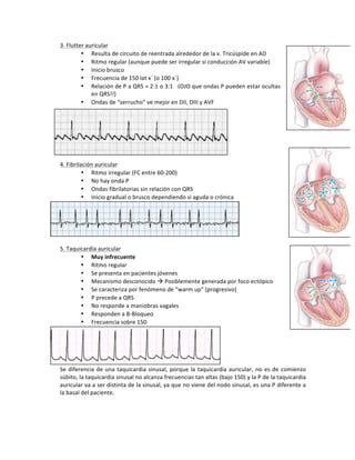 3.!Flutter!auricular!
• Resulta!de!circuito!de!reentrada!alrededor!de!la!v.!Tricúspide!en!AD!
• Ritmo!regular!(aunque!puede!ser!irregular!si!conducción!AV!variable)!
• Inicio!brusco!
• Frecuencia!de!150!lat!x`!(o!100!x`)!
• Relación!de!P!a!QRS!=!2:1!o!3:1!!!(OJO!que!ondas!P!pueden!estar!ocultas!
en!QRS!!)!
• Ondas!de!“serrucho”!ve!mejor!en!DII,!DIII!y!AVF!
!
!
!
!
!
!
!
4.!Fibrilación!auricular!
• Ritmo!irregular!(FC!entre!60V200)!
• No!hay!onda!P!
• Ondas!fibrilatorias!sin!relación!con!QRS!
• Inicio!gradual!o!brusco!dependiendo!si!aguda!o!crónica!
!
!
5.!Taquicardia!auricular!
• Muy(infrecuente!
• Ritmo!regular!
• Se!presenta!en!pacientes!jóvenes!
• Mecanismo!desconocido!!!Posiblemente!generada!por!foco!ectópico!!
• Se!caracteriza!por!fenómeno!de!“warm!up”!(progresivo)!
• P!precede!a!QRS!
• No!responde!a!maniobras!vagales!
• Responden!a!BVBloqueo!
• Frecuencia!sobre!150!
!
Se!diferencia!de!una!taquicardia!sinusal,!porque!la!taquicardia!auricular,!no!es!de!comienzo!
súbito,!la!taquicardia!sinusal!no!alcanza!frecuencias!tan!altas!(bajo!150)!y!la!P!de!la!taquicardia!
auricular!va!a!ser!distinta!de!la!sinusal,!ya!que!no!viene!del!nodo!sinusal,!es!una!P!diferente!a!
la!basal!del!paciente.!!
!
!
 