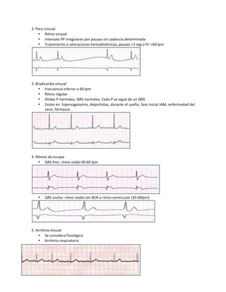 2.!Paro!sinusal!
• Ritmo!sinusal!
• Intervalo!PP!irregulares!por!pausas!sin!cadencia!determinada!
• Tratamiento!si!alteraciones!hemodinámicas,!pausas!>3!seg!o!FC!<60!lpm!
!
!
3.!Bradicardia!sinusal!
• Frecuencia!inferior!a!60!lpm!
• Ritmo!regular!
• Ondas!P!normales,!QRS!normales.!Cada!P!se!sigue!de!un!QRS!
• Existe!en:!hipervagotemia,!deportistas,!durante!el!sueño,!fase!inicial!IAM,!enfermedad!del!
seno,!fármacos.!!
!
!
4.!Ritmos!de!escape!
• QRS!fino:!ritmo!nodal!40H60!lpm!
!
• QRS!ancho:!ritmo!nodal!con!BCR!o!ritmo!ventricular!(30H40lpm)!
!
!
5.!Arritmia!sinusal!
• Se!considera!fisiológica!
• Arritmia!respiratoria!
!
!
!
!
 