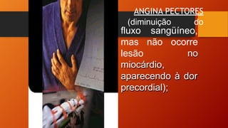 ANGINA PECTORES
(diminuição do
sangüíneo,
fluxo
mas não
lesão
ocorre
no
miocárdio,
aparecendo à dor
precordial);
 