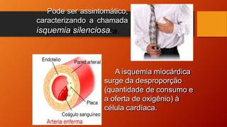 Pode ser assintomático,
caracterizando a chamada
isquemia silenciosa.
A isquemia miocárdica
surge da desproporção
(quantidade de consumo e
a oferta de oxigênio) à
célula cardíaca.
 