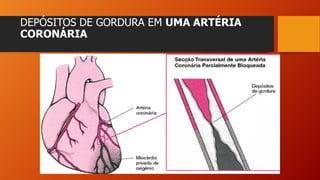 DEPÓSITOS DE GORDURA EM UMA ARTÉRIA
CORONÁRIA
 