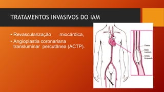 TRATAMENTOS INVASIVOS DO IAM
• Revascularização miocárdica,
• Angioplastia coronariana
transluminar percutânea (ACTP).
 
