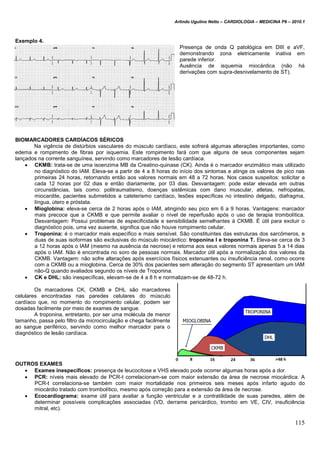 Arlindo Ugulino Netto – CARDIOLOGIA – MEDICINA P6 – 2010.1
115
Exemplo 4.
Presença de onda Q patológica em DIII e aVF,
demonstrando zona eletricamente inativa em
parede inferior.
Ausência de isquemia miocárdica (não há
derivações com supra-desnivelamento de ST).
BIOMARCADORES CARDÍACOS SÉRICOS
Na vigência de distúrbios vasculares do músculo cardíaco, este sofrerá algumas alterações importantes, como
edema e rompimento de fibras por isquemia. Este rompimento fará com que alguns de seus componentes sejam
lançados na corrente sanguínea, servindo como marcadores de lesão cardíaca.
 CKMB: trata-se de uma isoenzima MB da Creatino-quinase (CK). Ainda é o marcador enzimático mais utilizado
no diagnóstico do IAM. Eleva-se a partir de 4 a 8 horas do início dos sintomas e atinge os valores de pico nas
primeiras 24 horas, retornando então aos valores normais em 48 a 72 horas. Nos casos suspeitos: solicitar a
cada 12 horas por 02 dias e então diariamente, por 03 dias. Desvantagem: pode estar elevada em outras
circunstâncias, tais como: politraumatismo, doenças sistêmicas com dano muscular, atletas, nefropatas,
miocardite, pacientes submetidos a cateterismo cardíaco, lesões específicas no intestino delgado, diafragma,
língua, útero e próstata.
 Mioglobina: eleva-se cerca de 2 horas após o IAM, atingindo seu pico em 6 a 9 horas. Vantagens: marcador
mais precoce que a CKMB e que permite avaliar o nível de reperfusão após o uso de terapia trombolítica.
Desvantagem: Possui problemas de especificidade e sensibilidade semelhantes à CKMB. É útil para excluir o
diagnóstico pois, uma vez ausente, significa que não houve rompimento celular.
 Troponina: é o marcador mais específico e mais sensível. São constituintes das estruturas dos sarcômeros, e
duas de suas isoformas são exclusivas do músculo miocárdico: troponina I e troponina T. Eleva-se cerca de 3
a 12 horas após o IAM (mesmo na ausência da necrose) e retorna aos seus valores normais apenas 5 a 14 dias
após o IAM. Não é encontrada no soro de pessoas normais. Marcador útil após a normalização dos valores da
CKMB. Vantagem: não sofre alterações após exercícios físicos extenuantes ou insuficiência renal, como ocorre
com a CKMB ou a mioglobina. Cerca de 30% dos pacientes sem alteração do segmento ST apresentam um IAM
não-Q quando avaliados segundo os níveis de Troponina.
 CK e DHL: são inespecíficas, elevam-se de 4 a 8 h e normalizam-se de 48-72 h.
Os marcadores CK, CKMB e DHL são marcadores
celulares encontradas nas paredes celulares do músculo
cardíaco que, no momento do rompimento celular, podem ser
dosadas facilmente por meio de exames de sangue.
A troponina, entretanto, por ser uma molécula de menor
tamanho, passa pelo filtro da microcirculação e chega facilmente
ao sangue periférico, servindo como melhor marcador para o
diagnóstico de lesão cardíaca.
OUTROS EXAMES
 Exames inespecíficos: presença de leucocitose e VHS elevado pode ocorrer algumas horas após a dor.
 PCR: níveis mais elevado de PCR-t correlacionam-se com maior extensão da área de necrose miocárdica. A
PCR-t correlaciona-se também com maior mortalidade nos primeiros seis meses após infarto agudo do
miocárdio tratado com trombolítico, mesmo após correção para a extensão da área de necrose.
 Ecocardiograma: exame útil para avaliar a função ventricular e a contratilidade de suas paredes, além de
determinar possíveis complicações associadas (VD, derrame pericárdico, trombo em VE, CIV, insuficiência
mitral, etc).
 