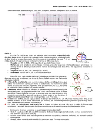 Arlindo Ugulino Netto – CARDIOLOGIA – MEDICINA P6 – 2010.1
18
Serão definidas e detalhadas agora cada onda, complexo, intervalo e segmento do ECG normal.
ONDA P
A onda P é devida aos potenciais elétricos gerados durante a despolarização
dos dois átrios, antes de se contrair. A sua primeira metade representa a despolarização
do átrio direito e a segunda metade, do átrio esquerdo. A amplitude da onda P é, em
média, de 0.25 mV, apresentando um tamanho normal de 2,5mm de altura.
 Duração: em DII, de 0,08 a 0,10 segundos (2 quadradinhos e meio).
 Morfologia: onda arredonda e monofásica, podendo apresentar pequenos entalhes (depressão próximo ao seu
vértice) devido à diferença relativamente normal da contração dos dois átrios. Na taquicardia, apresenta-se
pontiaguda.
 Amplitude: em DII, de 2,5 a 3,0 mm (0,25 a 0,3mV).
 Polaridade: Positiva em DI, DII e DIII. Negativa em aVR.
Como foi visto, cada metade da onda P representa um átrio. Por esta razão,
algumas patologias envolvendo os átrios de forma isolada podem ser facilmente
detectadas no ECG.
A hipertrofia atrial direita pode ocorrer em casos de hipertensão pulmonar, que
reflete na insuficiência ventricular direita e, tardiamente, na insuficiência atrial
direita, a qual cursa com uma hipertrofia atrial que se mostra, no ECG, na forma
de uma onda P espiculada na sua primeira metade.
A estenose mitral (redução do diâmetro da valva atrioventricular esquerda) pode
ser causada pela cardite pós-estreptocócica, como manifestação tardia da febre
reumática. Esta condição faz com que se acumule cada vez mais sangue no atrio
esquerdo, aumentando a sua sobrecarga e, a longo prazo, o seu tamanho. A
hipertrofia atrial esquerda produz um alongando a onda P no ECG.
Na estenose aortica, devido a pouca saída de sangue do ventrículo, há um refluxo do mesmo para o átrio, o que
também aumenta as suas fibras. Isso ocorre, por exemplo, em pacientes hipertensos (PA maior que 140/90). Nesse
caso, haverá alteração também na onda QRS.
Em casos de comunicação interatrial (CIA) – doença congênita em que não há a oclusão do forame oval
embrionário – a onda P é prolongada devido ao aumento de carga sanguínea a ser bombeada pelos atrios.
Em resumo, devemos considerar os seguintes parâmetros da onda P:
 Onda P negativa em DI, DII e/ou DIII representa dextrocardia (coração do lado direito) ou mau posicionamento
dos eletrodos (causa mais comum).
 Quando o átrio direito está crescido (devido a estenose tricúspide ou estenose pulmonar), faz a onda P crescer
em amplitude.
 Quando o átrio esquerdo está crescido faz com que a onda P cresça em duração.
 
