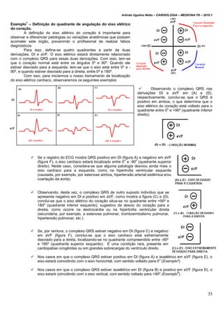 Arlindo Ugulino Netto – CARDIOLOGIA – MEDICINA P6 – 2010.1
35
Exemplo
1
– Definição do quadrante de angulação do eixo elétrico
do coração.
A definição do eixo elétrico do coração é importante para
observar e diferenciar patologias ou variações anatômicas que possam
acometer este órgão, prevenindo o profissional de realizar falsos
diagnósticos.
Para isso, define-se quatro quadrantes a partir de duas
derivações: DI e aVF. O eixo elétrico estará diretamente relacionado
com o complexo QRS para essas duas derivações. Com isso, tem-se
que o coração normal está entre os ângulos 0º e 90º. Quando ele
estiver desviado para a esquerda, tem-se que o eixo está entre 0º a -
90º, e quando estiver desviado para a direita, entre 0º e 180º.
Com isso, para iniciarmos o nosso treinamento de localização
do eixo elétrico cardíaco, observaremos os seguintes exemplos:
 Observando o complexo QRS nas
derivações DI e aVF em (A) e (D),
respectivamente, conclui-se que o QRS é
positivo em ambos, o que determina que o
eixo elétrico do coração está voltado para o
quadrante entre 0
o
e +90º (quadrante inferior
direito).
 Se o registro do ECG mostra QRS positivo em DI (figura A) e negativo em aVF
(figura F), o eixo cardíaco estará localizado entre 0
o
e -90
o
(quadrante superior
direito). Neste caso, considera-se que alguma patologia desviou ainda mais o
eixo cardíaco para a esquerda, como na hipertrofia ventricular esquerda
(causada, por exemplo, por estenose aórtica, hipertensão arterial sistêmica e/ou
coartação da aorta).
 Observando, desta vez, o complexo QRS de outro suposto indivíduo que se
apresenta negativo em DI e positivo em aVF, como mostra a figura (C) e (D),
conclui-se que o eixo elétrico do coração situa-se no quadrante entre +90º e
180º (quadrante inferior esquerdo), sugestivo de desvio do coração para a
direita, como ocorre na dextrocardia ou na hipertrofia ventricular direita
(secundária, por exemplo, a estenose pulmonar, tromboembolismo pulmonar,
hipertensão pulmonar, etc.).
 Se, por ventura, o complexo QRS estiver negativo em DI (figura C) e negativo
em aVF (figura F), conclui-se que o eixo cardíaco está extremamente
desviado para a direta, localizando-se no quadrante compreendido entre -90º
e 180º (quadrante superior esquerdo). É uma condição rara, presente em
cardiopatias congênitas ou em grandes sobrecargas do ventrículo direito.
 Nos casos em que o complexo QRS estiver positivo em DI (figura A) e isoelétrico em aVF (figura E), o
eixo estará coincidindo com o eixo horizontal, com sentido voltado para 0
o
(Exemplo²).
 Nos casos em que o complexo QRS estiver isoelétrico em DI (figura B) e positivo em aVF (figura D), o
eixo estará coincidindo com o eixo vertical, com sentido voltado para +90º (Exemplo
8
).
 