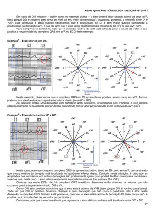 Arlindo Ugulino Netto – CARDIOLOGIA – MEDICINA P6 – 2010.1
37
Em caso de DIII negativo – assim como no exemplo acima – o eixo deverá estar situado acima do vetor aVR
(isso porque DIII é negativo para cima do nível de seu vetor perpendicular), ocupando, portanto, o intervalo entre 0º e
+30º. Esta conclusão é clara quando observamos que a positividade de DI é bem maior quando comparada à
positividade da derivação aVF, o que faz com que o eixo esteja realmente mais próximo de DI (0
o
) do que aVF (90º).
Para comprovar a conclusão, note que o eletrodo positivo de aVR está olhando para a cauda do vetor, o que
justifica a negatividade do complexo QRS em aVR no ECG deste exemplo.
Exemplo
4
– Eixo elétrico em 30º.
Neste exemplo, observamos que o complexo QRS em DI apresenta-se positivo, assim como em aVF. Temos,
portanto, um eixo localizado no quadrante inferior direito (entre 0
o
e 90º).
Ao procurar, então, uma derivação com complexo QRS isoelétrico, encontramos DIII. Portanto, o eixo elétrico
estará justamente no quadrante inferior direito, coincidindo com o vetor perpendicular à DIII: a derivação aVR (30
o
).
Exemplo
5
– Eixo elétrico entre 30º e 60º.
Neste caso, observamos que o complexo QRS se apresenta positivo tanto em DI como em aVF, demonstrando
que o eixo elétrico do coração está localizado no quadrante inferior direito. Contudo, nesta situação, é claro que as
amplitudes dos complexos em ambas derivações são praticamente iguais (isso poderá facilitar nas nossas conclusões:
veremos que, neste caso, o eixo estará exatamente equidistante entre os dois vetores DI e aVF).
Observe que neste ECG, não há complexo QRS isoelétrico. Devemos então observar os vetores que não
cruzam o quadrante pré-determinado: DIII e aVL.
Como DIII está positivo, conclui-se que o eixo estará abaixo de aVR (isso porque DIII é positivo para baixo).
Toda vez que DIII for positivo, devemos observar a outra derivação que não cruza o quadrante, isto é aVL: nesta
derivação, o complexo QRS também está positivo e, com isso, o eixo estará acima da derivação DII (isso porque aVL é
positiva para cima do nível de seu vetor perpendicular).
Conclui-se, pois que o vetor resultante que representa o eixo elétrico cardíaco está localizado entre 30º e 60º.
 