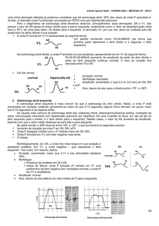 Arlindo Ugulino Netto – CARDIOLOGIA – MEDICINA P6 – 2010.1
40
uma única derivação alterada já podemos considerar que há sobrecarga atrial. 90% dos casos de onda P apiculada é,
de fato, a chamada onda P pulmonale, provocada por DPOC e/ou por hipertensão pulmonar.
Para o diagnóstico de sobrecarga atrial devemos observar, principalmente, duas derivações: DII e V1. Isto
porque o eixo de DII passa do braço direito para a perna esquerda, exatamente como o vetor da despolarização atrial
(isto é, 60°): de cima para baixo, da direita para a esquerda. A derivação V1, por sua vez, deve ser avaliada pois ela
avalia bem os átrios devido à sua posição.
 A onda P normal em V1 é representada da seguinte forma:
Um padrão conhecido como PLUS-MINUS (de forma que
primeira parte representa o átrio direito e a segunda, o átrio
esquerdo).
Na sobrecarga atrial direita, a onda P aumenta na sua amplitude, apresentando-se em V1 da seguinte forma:
PLUS-PLUS-MINUS (aumento da amplitude da parte do átrio direito e
parte do átrio esquerdo continua normal). O eixo do coração fica
desviado entre 70 e 90°.
 Em DII, temos:
 Duração: normal
 Morfologia: apiculada.
 Amplitude: aumentada (> que 2,5 ou 3,0 mm) em DII, DIII
e aVF
 Eixo: desvio do eixo para a direita (entre +70º e +90º)
2. Sobrecarga atrial esquerda
A sobrecarga atrial esquerda é mais comum do que a sobrecarga do átrio direito. Nesta, a onda P está
aumentada em duração, podendo apresentar-se maior do que 0,12 segundos (alguns livros afirmam um pouco maior
que 0,10 segundos) e de aspecto bífido.
As causas mais comuns de sobrecarga atrial são: estenose mitral; estenose/insuficiencia aórtica; coartação da
aorta, comunicação intra-atrial com hipertensão pulmonar por hiperfluxo (há uma inversão do fluxo, em vez de ser do
átrio esquerdo para o direito, é o átrio direito para o esquerdo). Nestes casos, o vetor do AE aumenta de amplitude,
fazendo com que o vetor médio desloque-se para trás e para esquerda.
No plano frontal, o SÂP situa-se entre +40° e +20°, o que promoverá os seguintes eventos:
 Aumento da duração da onda P em DII, DIII, aFV;
 Onda P alargada e bífida com o 2º módulo maior em DII, DIII;
 Onda P bimodal em V1 com fase negativa mais lenta;
 P mitrale.
Morfologicamente, em DII, a onda fica mais longa em sua duração e
apresenta entalhes. Em V1, a onda negativa – que representa o átrio
esquerdo – fica maior. Em resumo, temos:
 Duração: aumentada, maior que 0,11 s nas derivações bipolares
(DII).
 Morfologia:
 Presença de entalhes em DI e DII;
 Índice de Morris: onda P bimodal (P mitrale) em V1 com
predomínio da fase negativa (em condições normais, a onda P
em V1 é isodifásica).
 Amplitude: normal
 Eixo: desvio do eixo elétrico do vetor médio de P para a esquerda.
 
