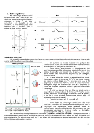Arlindo Ugulino Netto – CARDIOLOGIA – MEDICINA P6 – 2010.1
41
3. Sobrecarga biatrial
As sobrecargas biatriais serão
caracterizadas pela associação dos
sinais de sobrecargas atriais direita e
esquerda: a onda P vai estar
aumentada em duração e em
amplitude. O eixo elétrico pode estar
desviado para a esquerda, para a
direita, ou estar na faixa normal.
Sobrecarga ventricular.
Há uma série de patologias que podem fazer com que os ventrículos hipertrofiem simultaneamente: hipertensão
arterial sistêmica, atletismo, entre outras.
Um aumento da massa muscular em qualquer dos
ventrículos vai causar um aumento da atividade elétrica cardíaca
e um aumento da voltagem do complexo QRS.
Como vimos anteriormente, a despolarização dos
ventrículos descreve três vetores cuja resultante fornece o eixo
elétrico do coração: vetor septal, vetor de parede livre e vetor
basal (sendo este praticamente desprezível). Em condições
normais, temos:
 O vetor septal tem direção da esquerda para a direita,
de cima para baixo, de forma que V1 “vê” a sua ponta, ou seja,
se mostra positivo. Logo, em V1, teremos uma onda r (R
pequena). Já a derivação V6 “vê” a cauda do vetor, mostrando-
se negativo. Logo, em V6 temos uma onda q (Q pequena). As
ondas se mostram pequenas devido à pequena intensidade
deste vetor.
 O vetor de parede livre se dirige da direita para a
esquerda e de cima para baixo, de forma que V1 “veja” a cauda,
ou seja, se mostre negativo (logo, V1 tem uma onda S grande);
já V6 “vê” a ponta do vetor, mostrando-se positivo (logo, V6
apresenta uma onda R grande).
 Portanto, temos em V1: rS e, em V2: qR.
Deste modo, as sobrecargas ventriculares vão fazer
com que o complexo QRS altere (aumente) de amplitude. Para o
diagnóstico das sobrecargas atriais devemos avaliar as
derivações do plano frontal (e também V1), enquanto que nas
sobrecargas ventriculares devemos avaliar as derivações
precordiais (V1, V5 e V6, em especial).
Se a massa muscular esquerda estiver aumentada (hipertrofia ventricular esquerda) o complexo QRS tem a
mesma morfologia, porém com a amplitude aumentada. Isto porque predomina o vetor septal e o vetor de parede livre
exacerbadamente. Ou seja, continua o rS em V1 e o qR em V6, diferenciando-se apenas por ondas S (em V1) e ondas
R (em V6) de amplitudes bem maiores.
 
