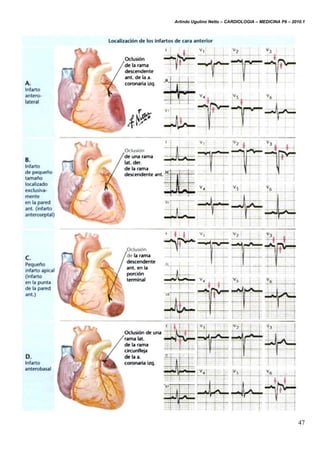 Arlindo Ugulino Netto – CARDIOLOGIA – MEDICINA P6 – 2010.1
47
 