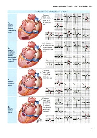 Arlindo Ugulino Netto – CARDIOLOGIA – MEDICINA P6 – 2010.1
48
 