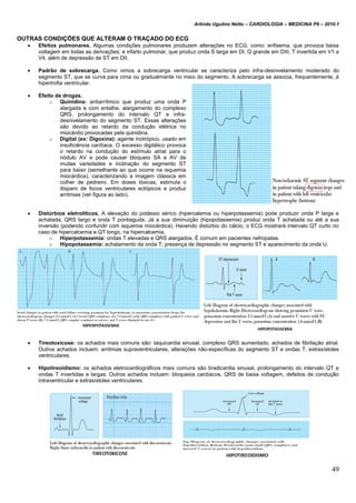 Arlindo Ugulino Netto – CARDIOLOGIA – MEDICINA P6 – 2010.1
49
OUTRAS CONDIÇÕES QUE ALTERAM O TRAÇADO DO ECG
 Efeitos pulmonares. Algumas condições pulmonares produzem alterações no ECG, como: enfisema, que provoca baixa
voltagem em todas as derivações; e infarto pulmonar, que produz onda S larga em DI, Q grande em DIII, T invertida em V1 a
V4, além de depressão de ST em DII.
 Padrão de sobrecarga. Como vimos a sobrecarga ventricular se caracteriza pelo infra-desnivelamento moderado do
segmento ST, que se curva para cima ou gradualmente no meio do segmento. A sobrecarga se associa, frequentemente, à
hipertrofia ventricular.
 Efeito de drogas.
o Quinidina: antiarrítmico que produz uma onda P
alargada e com entalhe, alargamento do complexo
QRS, prolongamento do intervalo QT e infra-
desnivelamento do segmento ST. Essas alterações
são devido ao retardo da condução elétrica no
miocárdio provocadas pela quinidina.
o Digital (ex: Digoxina): agente inotrópico, usado em
insuficiência cardíaca. O excesso digitálico provoca
o retardo na condução do estímulo atrial para o
nódulo AV e pode causar bloqueio SA e AV de
muitas variedades e inclinação do segmento ST
para baixo (semelhante ao que ocorre na isquemia
miocárdica), caracterizando a imagem clássica em
colher de pedreiro. Em doses tóxicas, estimula o
disparo de focos ventriculares ectópicos e produz
arritmias (ver figura ao lado).
 Distúrbios eletrolíticos. A elevação do potássio sérico (hipercalemia ou hiperpotassemia) pode produzir onda P larga e
achatada, QRS largo e onda T pontiaguda. Já a sua diminuição (hipopotassemia) produz onda T achatada ou até a sua
inversão (podendo confundir com isquemia miocárdica). Havendo distúrbio do cálcio, o ECG mostrará intervalo QT curto no
caso de hipercalcemia e QT longo, na hipercalcemia.
o Hiperpotassemia: ondas T elevadas e QRS alargados. É comum em pacientes nefropatas.
o Hipopotassemia: achatamento da onda T, presença de depressão no segmento ST e aparecimento da onda U.
 Tireotoxicose: os achados mais comuns são: taquicardia sinusal, complexo QRS aumentado, achados de fibrilação atrial.
Outros achados incluem: arritmias supraventriculares, alterações não-específicas do segmento ST e ondas T, extrasístoles
ventriculares.
 Hipotireoidismo: os achados eletrocardiográficos mais comuns são bradicardia sinusal, prolongamento do intervalo QT e
ondas T invertidas e largas. Outros achados incluem: bloqueios cardíacos, QRS de baixa voltagem, defeitos de condução
intraventricular e extrasístoles ventriculares.
 