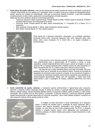Arlindo Ugulino Netto – CARDIOLOGIA – MEDICINA P6 – 2010.1
57
 Corte apical de quatro câmaras: corte do tipo bidimensional obtido quando se coloca o transdutor na ponta do
coração, observando-se com clareza as 4 cavidades. Este é o melhor corte para o estudo da dopplerfluximetria;
porém, deve-se ter cuidado na interpretação, visto que as estruturas estarão invertidas: o que está localizado
anatomicamente no lado direito, aparecerá no ecocardiograma do lado esquerdo.
Neste tipo de corte, podemos observar muito frequentemente:
o Ventrículo esquerdo: Ápice superiormente, Parede lateral à direita, Parede septal à esquerda, Folhetos
da Mitral inferiormente, FA à esquerda FP à direita.
o Ventrículo direito: Parede lateral VD (BM), septo intraventricular, V. Tricúspide (F.S. à direita, F.A. à
esquerda).
o Átrio esquerdo: Parede lateral, V. Mitral, septo interatrial e parede superior.
o Átrio direito: Parede lateral, VT, SIA, parede superior.
Corte apical de 4 câmaras mostrando, claramente, as cavidades cardíacas:
ventrículo direito (VD), ventrículo esquerdo (VE), átrio esquerdo (AE), átrio
direito (AD), valva tricúspide (T) e mitral (M) e os septos interatrial e
interventricular.
Corte apical de cinco câmaras (quando o transdutor é voltado um pouco
mais anteriormente para o aparecimento da 5ª câmara: a aorta). A aorta
ascedente, cortada longitudinalmente (AO) ocupa o centro da imagem. A via de
saída do VE é o espaço existente entre o folheto anterior da valva mitral (M) e o
septo interventricular (S). É o melhor corte para o estudo do fluxo aórtico.
Se observa que o septo interatrial parece que está incompleto. Daí que,
podemos dizer que a resolução do eco lateral é pobre. Quando se procede da
angulação do transdutor para a ponta do coração, aí sim é possível visualizar a
via de saída do ventrículo esquerdo, aorta (sendo importante para identificar as
cardiomiopatias hipertróficas). Neste caso em especifico, o septo está muito
desenvolvido e oclui a passagem do sangue, podendo determinar uma morte
súbita.
 Corte subxifoide de quatro câmaras: o transdutor aponta anteriormente e ligeiramente para esquerda,
devendo o paciente manter inspiração forçada. À direita do monitor, é possível observar VD (parede póstero-
lateral e parede septal), válvula tricúspide (folheto anterior à esquerda e folheto septal à direita) e o átrio direito
(tricúspide, SIA e parede livre do átrio direito). À esquerda, é possível observar o ventrículo esquerdo (parede
septal interventricular e parede lateral alta do ventrículo esquerdo), valva mitral (folheto posterior e anterior) eo
átrio esquerdo (válvula mitral, parede posterior e SAI).
A imagem ao lado demonstra o corte subxifoidiano de 4 câmaras,
sendo o método de escolha para a avaliação do septo interatrial. Não é
incomum que, alguns pacientes, apresentem uma posição anômala do
coração, em que este se situa mais posteriormente. No ECG, é possível
detectar a rotação horária, assim como alterações que verticalizam a
anatomia cardíaca. O melhor método para avaliar o septo interatrial é o corte
transesofágico.
 