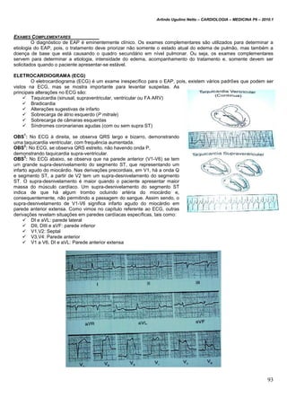 Arlindo Ugulino Netto – CARDIOLOGIA – MEDICINA P6 – 2010.1
93
EXAMES COMPLEMENTARES
O diagnóstico de EAP é eminentemente clínico. Os exames complementares são utilizados para determinar a
etiologia do EAP, pois, o tratamento deve priorizar não somente o estado atual do edema de pulmão, mas também a
doença de base que está causando o quadro secundário em nível pulmonar. Ou seja, os exames complementares
servem para determinar a etiologia, intensidade do edema, acompanhamento do tratamento e, somente devem ser
solicitados quando o paciente apresentar-se estável.
ELETROCARDIOGRAMA (ECG)
O eletrocardiograma (ECG) é um exame inespecífico para o EAP, pois, existem vários padrões que podem ser
vistos na ECG, mas se mostra importante para levantar suspeitas. As
principais alterações no ECG são:
 Taquicardia (sinusal, supraventricular, ventricular ou FA ARV)
 Bradicardia
 Alterações sugestivas de infarto
 Sobrecarga de átrio esquerdo (P mitrale)
 Sobrecarga de câmaras esquerdas
 Síndromes coronarianas agudas (com ou sem supra ST)
OBS
1
: No ECG à direita, se observa QRS largo e bizarro, demonstrando
uma taquicardia ventricular, com frequência aumentada.
OBS
2
: No ECG, se observa QRS estreito, não havendo onda P,
demonstrando taquicardia supra-ventricular.
OBS
3
: No ECG abaixo, se observa que na parede anterior (V1-V6) se tem
um grande supra-desnivelamento do segmento ST, que representando um
infarto agudo do miocárdio. Nas derivações precordiais, em V1, há a onda Q
e segmento ST, a partir de V2 tem um supra-desnivelamento do segmento
ST. O supra-desnivelamento é maior quando o paciente apresentar maior
massa do músculo cardíaco. Um supra-desnivelamento do segmento ST
indica de que há algum trombo ocluindo artéria do miocárdio e,
consequentemente, não permitindo a passagem do sangue. Assim sendo, o
supra-desnivelamento de V1-V6 significa infarto agudo do miocárdio em
parede anterior extensa. Como vimos no capítulo referente ao ECG, outras
derivações revelam situações em paredes cardíacas específicas, tais como:
 DI e aVL: parede lateral
 DII, DIII e aVF: parede inferior
 V1,V2: Septal
 V3,V4: Parede anterior
 V1 a V6, DI e aVL: Parede anterior extensa
 