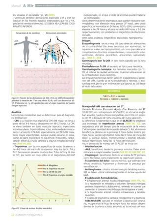 Manual A Mir www.academiamir.com 
les, situadas en la espalda: V7, V8 (MIR). 
- Ventrículo derecho: derivaciones especiales V3R y V4R (se 
colocan en los mismos espacios intercostales que V3 y V4, 
pero en el hemitórax derecho). SE DEBEN REALIZAR EN TODO 
INFARTO INFERIOR. 
Derivaciones de los miembros Derivaciones precordiales 
V1 
V2 
III II 
Figura 9. Posición de las derivaciones de ECG. ECG con IAM inferoposterior: 
apréciese la elevación del ST en cara inferior (II, III y aVF) con descenso en V1- 
V2. El descenso en I y aVL aporta más valor al origen isquémico del cuadro 
(imagen especular). 
Analítica 
Las enzimas miocárdicas que se determinan para el diagnósti-co 
del IAM son: 
- CPK y su fracción más específica CPK-MB masa: se eleva a 
partir de las 4-6 horas y desaparece en 48-72 horas. La CPK 
se eleva también en daño muscular (ejercicio, inyecciones 
intramusculares, hipotiroidismo, ictus, enfermedades muscu-lares). 
La fracción CPK-MB, especialmente la CPK-MB2 masa, 
tiene mayor especificidad, aunque puede elevarse en situa-ciones 
de daño miocárdico no isquémico: miocarditis, cardio-versión 
eléctrica, cirugía cardíaca y algunas neoplasias malig-nas 
(MIR 00, 98). 
- Troponinas: son las más específicas de todas. Se elevan a 
las 4-6 horas del inicio de la isquemia. Hay dos tipos: TnI y 
TnT. Permanecen elevadas muchos días: 7 días la TnI y 14 días 
la TnT, por tanto son muy útiles en el diagnóstico del IAM 
evolucionado, en el que el resto de enzimas pueden haberse 
ya normalizado. 
Otras determinaciones enzimáticas que pueden realizarse son: 
mioglobina, con elevación muy precoz (2ª hora), pero poco 
específica; se normaliza en 24 horas; GOT y LDH, comienzan a 
elevarse a las 24 horas y el pico es tardío (48 horas y 3-5 día, 
respectivamente), con utilidad en el diagnóstico de IAM evolu-cionado. 
Otros datos analíticos, inespecíficos: leucocitosis, hiperglucemia. 
Imagen 
Ecocardiograma: técnica muy útil para detectar alteraciones 
de la contractilidad (las áreas necróticas son aquinéticas; las 
isquémicas suelen ser hipoquinéticas), así como para descartar 
complicaciones (trombos intraventiculares, comunicación inter-ventricular, 
derrame pericárdico, aneurismas, valvulopatí-as… 
(MIR 01, 48)). 
Gammagrafía con Ta-201: el talio no es captado por la zona 
necrótica. 
Pirofosfato con Tc-99: el tecnecio se fija a zona necrótica. 
Ventriculografía isotópica: los hematíes marcados con Tc- 
99, al rellenar la cavidad ventricular, muestran alteraciones de 
la contractilidad; poco específico. 
Las tres últimas técnicas tienen valor en el diagnóstico a poste-riori 
del IAM, cuando ya se ha establecido la necrosis. El eco-cardiograma, 
por la gran información que aporta, es útil desde 
el inicio del cuadro. 
RECUERDA 
Manejo del IAM con elevación del ST 
Llamado Síndrome Coronario Agudo Con Elevación del ST 
(SCACEST), en contraposición al SCASEST, en el cual se englo-ban 
aquellos cuadros clínicos compatibles con ECG con ascen-so 
del ST o bloqueo de rama izquierda de nueva aparición. 
La diferencia fundamental es que en el SCACEST se establece 
una estrategia de reperfusión precoz (MIR 06, 32), con 
importancia vital del tiempo para la instauración de la misma 
("el tiempo es cantidad de miocardio salvado"). Así, el máximo 
beneficio se obtiene en la primeras 3 horas (sobre todo la pri-mera 
hora), siendo significativo hasta las 6 horas de inicio del 
dolor, y, aunque escaso, manteniéndose y estando indicado 
realizar reperfusión, hasta las 12 horas de evolución. 
Así, el protocolo de manejo del SCACEST se inicia con: 
- Monitorización. 
- AAS, beneficioso desde los primeros minutos. Debe admi-nistrarse 
a la mayor brevedad posible (MIR 99, 20; MIR 98F, 92). 
- Clopidogrel: beneficioso tanto si se realiza ACTP primaria 
como fibrinólisis como tratamiento de reperfusión precoz. 
- Tratamiento del dolor: cloruro mórfico, que además tiene 
efecto ansiolítico, hipotensor y disminuye la precarga por 
vasodilatación. 
- Antianginosos: nitratos intravenosos y/o betabloqueantes. 
NO se deben utilizar calcioantagonistas en la fase aguda del 
IAM. 
- Estabilización hemodinámica: 
• Si hipotensión arterial: fluidos intravenosos (MIR 97F, 58). 
Si la hipotensión es refractaria a volumen: fármacos inotropos 
positivos (dopamina y dobutamina), teniendo en cuenta que 
aumentan el consumo miocárdico pudiendo agravar el daño. 
• Si hipertensión arterial: nitratos intravenosos y betablo-queantes. 
• Si datos de insuficiencia cardíaca: nitroglicerina IV y diuréticos. 
- REPERFUSIÓN: consiste en resolver la obstrucción corona-ria, 
recuperando el flujo de sangre hacia los tejidos depen-dientes 
de la arteria ocluida, evitando así la necrosis del mio- 
Pico A: Mioglobina 
Pico B: Troponinas tras IAM 
Pico C: CK-MB tras IAM 
Pico D: Troponinas en angina inestable 
A 
B 
C 
D 
0 1 2 3 4 5 6 7 8 
50 
20 
10 
5 
2 
1 
22 ] CARDIOPATÍA ISQUÉMICA [ 
V3 V4 V5 V6 
Figura 10. Curvas de enzimas de daño miocárdico. 
TalIO = frIO = necrosis 
TeCnecio = Caliente = necrosis 
aVR aVL 
aVF 
I 
 