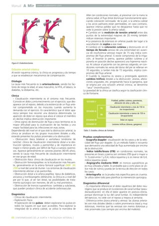 Manual A Mir www.academiamir.com 
Figura 8. Endarterectomía. 
Oclusión arterial crónica 
Al existir isquemia crónica, la clínica es progresiva y da tiempo 
a que se establezcan mecanismos de compensación. 
Etiología 
La causa más frecuente es la arteriosclerosis, siendo los fac-tores 
de riesgo la edad, el sexo masculino, la HTA, el tabaco, la 
diabetes, la dislipemia, etc. 
Clínica 
- Claudicación intermitente es el síntoma más frecuente. 
Consiste en dolor y entumecimiento con el ejercicio, que des-aparece 
con el reposo, debido a la existencia de un flujo arte-rial 
comprometido en los músculos cuando aumenta la 
demanda con el ejercicio. Es característico que el dolor apa-rezca 
siempre tras recorrer una distancia determinada. La 
aparición de dolor en reposo que alivia al colocar el miembro 
en declive implica obstrucción importante. 
- Otros signos de disminución de flujo a esos territorios es la 
mayor dificultad para la cicatrización de las heridas y una 
mayor facilidad para las infecciones en esas zonas. 
Dependiendo del nivel en el que esté la obstrucción arterial, la 
clínica se produce en los grupos musculares distales a ella, 
estando presentes los pulsos proximales a la obstrucción: 
- Obstrucción ilíaca bilateral o aortoilíaca (síndrome de 
Leriche): clínica de claudicación intermitente distal a la obs-trucción 
(glúteos, muslos y pantorrilla) y de impotencia en 
mayor o menor grado, por déficit de flujo a cuerpos caverno-sos. 
Aparece generalmente en varones jóvenes (40-45 años), 
siendo la causa más frecuente de claudicación intermitente 
en ese grupo de edad. 
- Obstrucción ilíaca: clínica de claudicación en los muslos. 
- Obstrucción femoropoplítea: es la localización más frecuen-te, 
generalmente en la arteria femoral superficial (MIR 00, 
259) a nivel del canal de Hunter. Los síntomas de claudicación 
intermitente afectan a las pantorrillas. 
- Obstrucción distal a la arteria poplítea: típica de diabéticos, 
ancianos y tromboangeítis obliterante; la clínica es a nivel del 
pie por lo que, al ser tan distal, las posibilidades de trata-miento 
quirúrgico son menores, de ahí su mal pronóstico. 
- Obstrucción de troncos supraórticos: carótidas y subclavias, 
que pueden producir clínica de accidente cerbrovascular. 
Diagnóstico 
- Clínica de claudicación intermitente. 
- Exploración física: 
• Exploración de los pulsos: deben explorarse los pulsos en 
todos los lugares en que sean accesibles. Para explorar la 
integridad de la arteria cubital, se utiliza la maniobra de 
Allen (en condiciones normales, al presionar con la mano la 
arteria radial, el flujo distal disminuye transitoriamente apre-ciando 
coloración sonrosada de la piel, si la arteria cubital 
y los arcos palmares están permeables; en caso contrario, 
aparece intensa palidez que no desaparece hasta que no 
cede la presión sobre la arteria radial). 
• Cambios en la medición de tensión arterial entre dos 
puntos de la extremidad mayores de 20 mmHg también 
indican estenosis importante. 
• La presencia de estenosis en arterias puede dar lugar a la 
auscultación de soplos a ese nivel. 
• Cambios en la coloración cutánea y disminución en el 
tiempo de llenado venoso de una extremidad (en ausen-cia 
de insuficiencia venosa) mayor de 15 seg indica com-promiso 
del flujo arterial. Si existe compromiso de la irriga-ción, 
al levantar la pierna, aparece palidez cutánea y al 
ponerla en posición declive aparecerá una hiperemia reacti-va. 
Al colocar al paciente con las piernas colgando, en con-diciones 
normales las venas del dorso del pie se rellenan en 
10 segundos; si tardan más de 15 segundos, implica com-promiso 
del flujo arterial. 
• Cuando la isquemia es severa y prolongada aparecen 
cambios tróficos distales a la obstrucción: úlceras, altera-ciones 
ungueales, etc. progresando hacia la gangrena, que 
se origina por una oclusión arterial crónica, se denomina 
"seca" (momificación). 
La gravedad de la clínica se clasifica según la clasificación clíni-ca 
de Fontaine. 
Frialdad, palidez cutánea, parestesias, 
alteración de uñas y vello, etc. 
ESTADIO I 
ESTADIO II 
ESTADIO III 
ESTADIO IV 
IIa 
IIb 
Claudicación intermitente a más de 150 m 
Pruebas complementarias 
- Ecografía-doppler: visualización de los vasos y de la velo-cidad 
del flujo por doppler. Es un método fiable e incruento 
que demuestra una velocidad de flujo aumentada por encima 
de la obstrucción. 
- Índice tobillo/brazo (ITB): en condiciones normales, las 
presiones en brazo y pierna son similares (ITB igual o mayor a 
1). Si está entre 1 y 0,4, indica isquemia y si es menor de 0,4, 
indica isquemia grave. 
- Angiografía mediante RNM: en troncos supraórticos ya 
es muy utilizada y fiable. Es probable que a corto plazo se uti-lice 
más de rutina y pueda ser la técnica de elección en todos 
los casos. 
- Arteriografía: es la prueba más específica pero es cruenta. 
Se utiliza sobre todo para planificar la intervención quirúrgica. 
Diagnóstico diferencial 
- Es importante diferenciar el dolor isquémico del dolor neu-rógeno 
que se produce en la estenosis de canal lumbar (pseu-doclaudicación): 
en ella el dolor aparece en postura erecta, 
porque disminuye la luz del canal lumbar. Es independiente 
del ejercicio, no cede con el reposo y mejora al sentarse. 
- Diferencia entre úlcera arterial y venosa: las úlceras arteria-les 
son más distales (dedos o sobre prominencia ósea) y muy 
dolorosas, mientras que las venosas son menos dolorosas y 
más proximales (casi siempre por encima del maléolo). 
46 ] ENFERMEDADES DE LA AORTA Y PATOLOGÍA ARTERIAL [ 
Tabla 3. Estadios clínicos de Fontaine. 
(no incapacitante) 
Claudicación intermitente a menos de 150 m 
(incapacitante) 
Dolor en reposo 
Lesiones tróficas (úlceras, gangrena) 
 