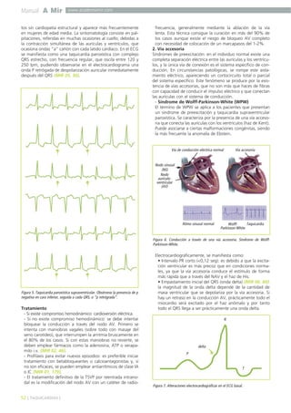 Manual A Mir www.academiamir.com 
tos sin cardiopatía estructural y aparece más frecuentemente 
en mujeres de edad media. La sintomatología consiste en pal-pitaciones, 
referidas en muchas ocasiones al cuello, debidas a 
la contracción simultánea de las aurículas y ventrículos, que 
ocasiona ondas “a” cañón con cada latido cardíaco. En el ECG 
se manifiesta como una taquicardia paroxística con complejo 
QRS estrecho, con frecuencia regular, que oscila entre 120 y 
250 lpm, pudiendo observarse en el electrocardiograma una 
onda P retrógada de despolarización auricular inmediatamente 
después del QRS (MIR 05, 30). 
Figura 5. Taquicardia paroxística supraventricular. Obsérvese la presencia de p 
negativa en cara inferior, seguida a cada QRS, o “p retrógrada”. 
Tratamiento 
- Si existe compromiso hemodinámico: cardioversión eléctrica. 
- Si no existe compromiso hemodinámico: se debe intentar 
bloquear la conducción a través del nodo AV. Primero se 
intenta con maniobras vagales (sobre todo con masaje del 
seno carotídeo), que interrumpen la arritmia bruscamente en 
el 80% de los casos. Si con estas maniobras no revierte, se 
deben emplear fármacos como la adenosina, ATP o verapa-milo 
i.v. (MIR 02, 46). 
- Profilaxis para evitar nuevos episodios: es preferible iniciar 
tratamiento con betabloqueantes o calcioantagonistas y, si 
no son eficaces, se pueden emplear antiarrítmicos de clase IA 
o IC (MIR 01, 179). 
- El tratamiento definitivo de la TSVP por reentrada intrano-dal 
es la modificación del nodo AV con un catéter de radio-frecuencia, 
generalmente mediante la ablación de la vía 
lenta. Esta técnica consigue la curación en más del 90% de 
los casos aunque existe el riesgo de bloqueo AV completo 
con necesidad de colocación de un marcapasos del 1-2%. 
2. Vía accesoria 
Síndromes de preexcitación: en el individuo normal existe una 
completa separación eléctrica entre las aurículas y los ventrícu-los, 
y la única vía de conexión es el sistema específico de con-ducción. 
En circunstancias patológicas, se rompe este aisla-miento 
eléctrico, apareciendo un cortocircuito total o parcial 
del sistema específico. Este fenómeno se produce por la exis-tencia 
de vías accesorias, que no son más que haces de fibras 
con capacidad de conducir el impulso eléctrico y que conectan 
las aurículas con el sistema de conducción. 
- Síndrome de Wolff-Parkinson-White (WPW) 
El término de WPW se aplica a los pacientes que presentan 
un síndrome de preexcitación y taquicardia supraventricular 
paroxística. Se caracteriza por la presencia de una vía acceso-ria 
que conecta las aurículas con los ventrículos (haz de Kent). 
Puede asociarse a ciertas malformaciones congénitas, siendo 
la más frecuente la anomalía de Ebstein. 
Vía de conducción eléctrica normal 
Nodo sinusal 
(NS) 
Nodo 
aurículo-ventricular 
(AV) 
Vía accesoria 
Ritmo sinusal normal Wolff- 
Parkinson-White 
Taquicardia 
Electrocardiográficamente, se manifiesta como: 
• Intervalo PR corto (<0,12 seg): es debido a que la excita-ción 
ventricular es más precoz que en condiciones norma-les, 
ya que la vía accesoria conduce el estímulo de forma 
más rápida que a través del NAV y el haz de His. 
• Empastamiento inicial del QRS (onda delta) (MIR 00, 84): 
la magnitud de la onda delta depende de la cantidad de 
masa ventricular que se depolariza por la vía accesoria. Si 
hay un retraso en la conducción AV, prácticamente todo el 
miocardio será excitado por el haz anómalo y por tanto 
todo el QRS llega a ser prácticamente una onda delta. 
52 ] TAQUICARDIAS [ 
Figura 6. Conducción a través de una vía accesoria. Síndrome de Wolff- 
Parkinson-White. 
delta 
R 
T 
P 
Figura 7. Alteraciones electrocardiográficas en el ECG basal. 
 